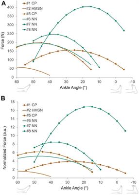 Quantifying the effects of achilles tendon lengthening surgery: An intraoperative approach